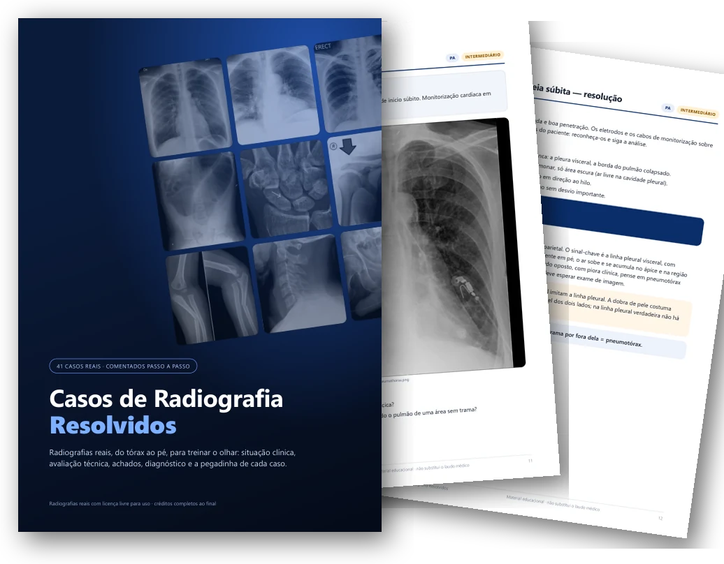Casos de Radiografia Resolvidos